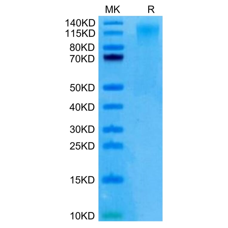 Tris-Bis PAGE - Recombinant Human CD96 Protein (C-terminal His Tag) (A330427) - Antibodies.com
