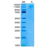 Tris-Bis PAGE - Recombinant Human CD96 Protein (C-terminal His Tag) (A330427) - Antibodies.com