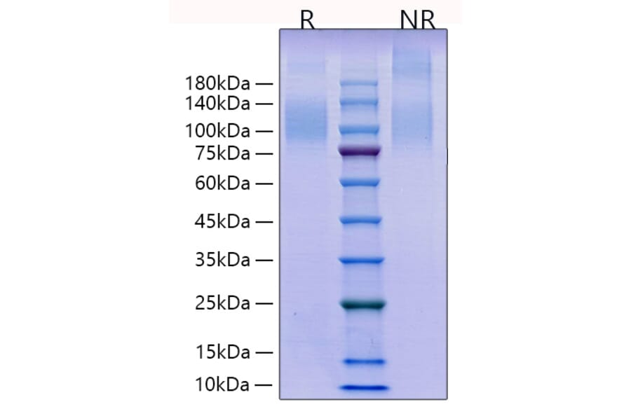 SDS-PAGE - Recombinant Human CD96 Protein (C-terminal His Tag) (A330428) - Antibodies.com