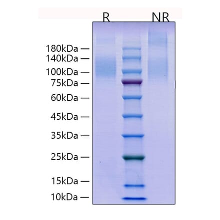 SDS-PAGE - Recombinant Human CD96 Protein (C-terminal His Tag) (A330428) - Antibodies.com