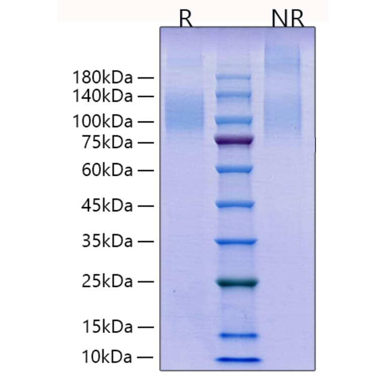 SDS-PAGE - Recombinant Human CD96 Protein (C-terminal His Tag) (A330428) - Antibodies.com