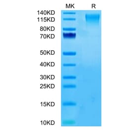 Tris-Bis PAGE - Recombinant Human CD96 Protein (C-terminal His Tag) (A330429) - Antibodies.com
