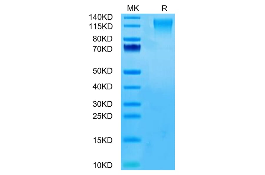Tris-Bis PAGE - Recombinant Human CD96 Protein (C-terminal His Tag) (A330429) - Antibodies.com