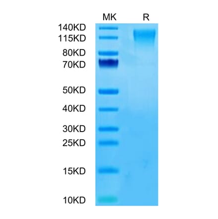 Tris-Bis PAGE - Recombinant Human CD96 Protein (C-terminal His Tag) (A330429) - Antibodies.com