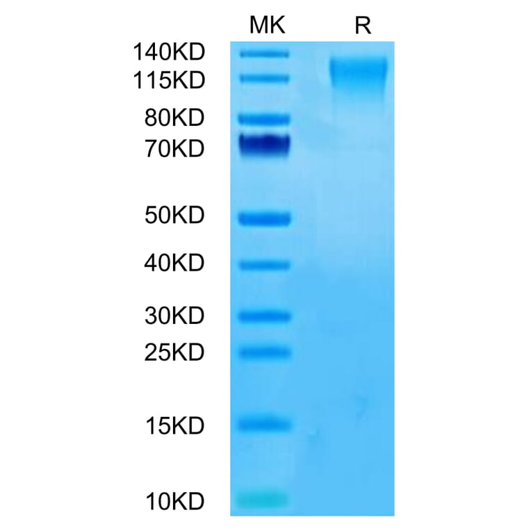 Tris-Bis PAGE - Recombinant Human CD96 Protein (C-terminal His Tag) (A330429) - Antibodies.com