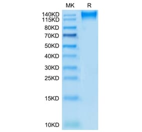 Tris-Bis PAGE - Recombinant Human CD96 Protein (C-terminal Mouse Fc Tag) (A330430) - Antibodies.com