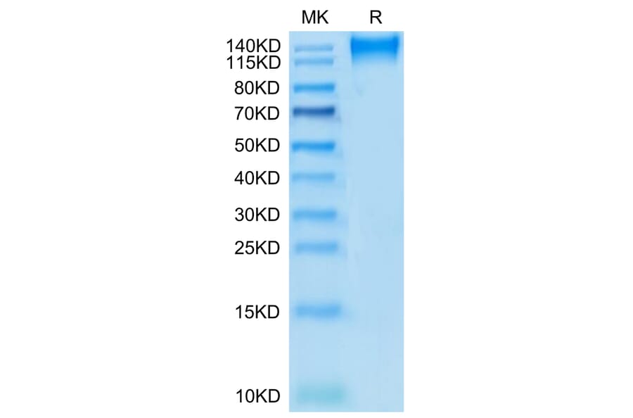 Tris-Bis PAGE - Recombinant Human CD96 Protein (C-terminal Mouse Fc Tag) (A330430) - Antibodies.com