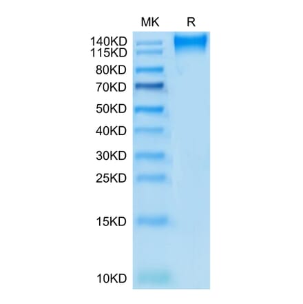 Tris-Bis PAGE - Recombinant Human CD96 Protein (C-terminal Mouse Fc Tag) (A330430) - Antibodies.com