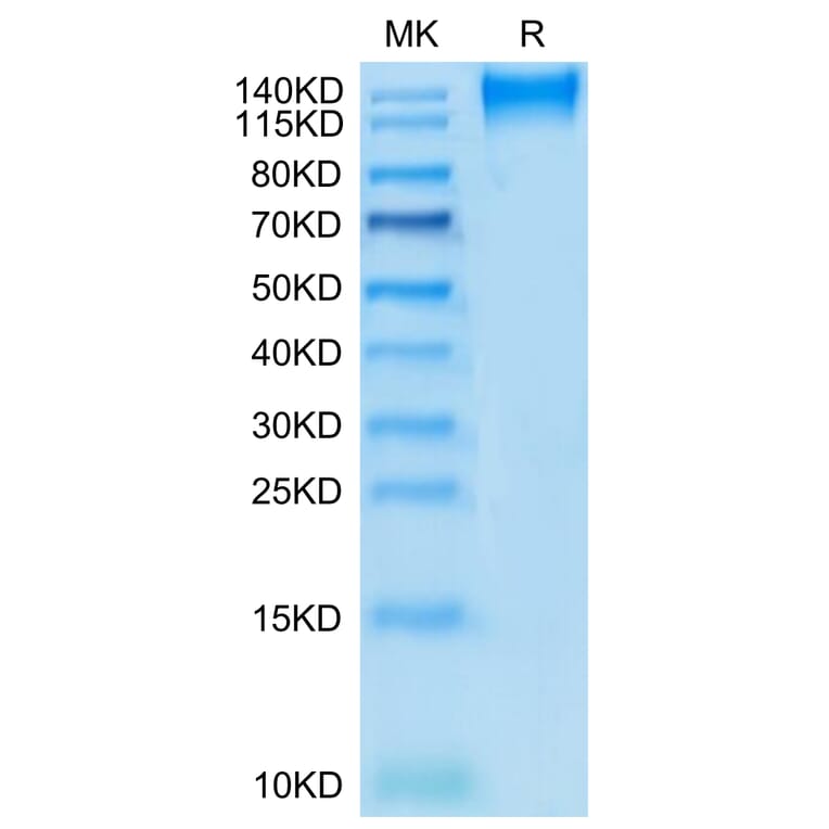 Tris-Bis PAGE - Recombinant Human CD96 Protein (C-terminal Mouse Fc Tag) (A330430) - Antibodies.com