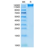 Tris-Bis PAGE - Recombinant Human CD96 Protein (C-terminal Mouse Fc Tag) (A330430) - Antibodies.com