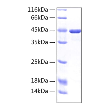 SDS-PAGE - Recombinant Human CD98 Protein (A330431) - Antibodies.com