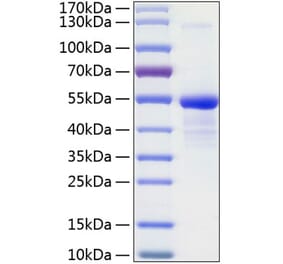 SDS-PAGE - Recombinant Human CD99 Protein (C-terminal Human Fc and His Tag) (A330432) - Antibodies.com