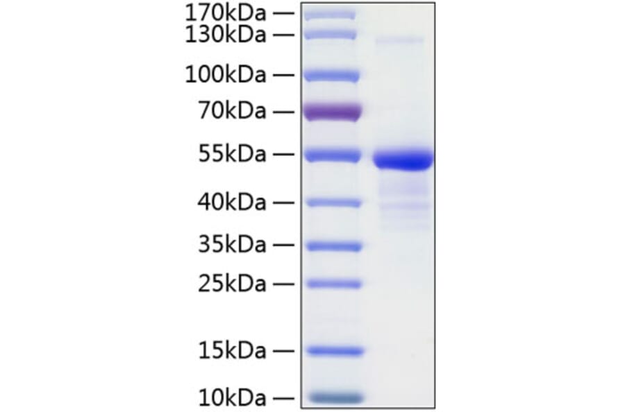 SDS-PAGE - Recombinant Human CD99 Protein (C-terminal Human Fc and His Tag) (A330432) - Antibodies.com