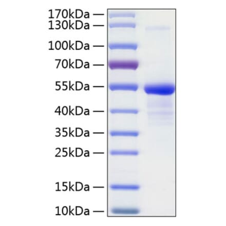 SDS-PAGE - Recombinant Human CD99 Protein (C-terminal Human Fc and His Tag) (A330432) - Antibodies.com