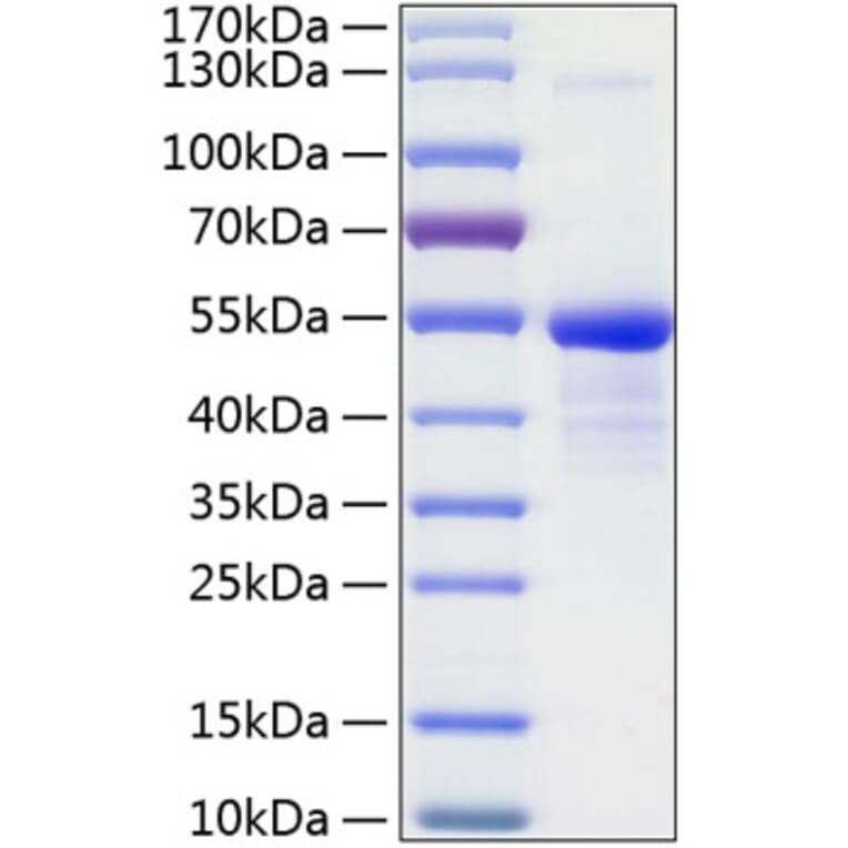 SDS-PAGE - Recombinant Human CD99 Protein (C-terminal Human Fc and His Tag) (A330432) - Antibodies.com