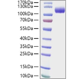 SDS-PAGE - Recombinant Human CDCP1 Protein (C-terminal His Tag) (A330434) - Antibodies.com