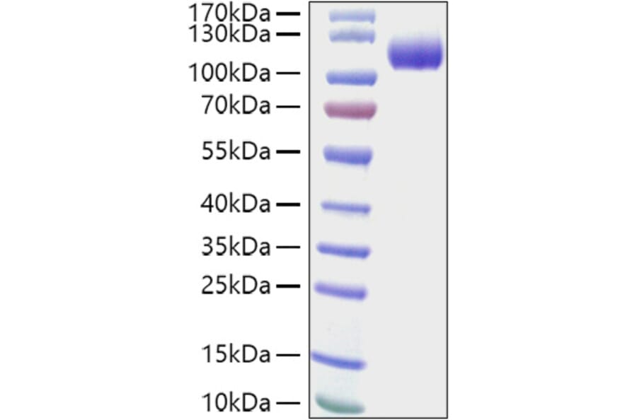 SDS-PAGE - Recombinant Human CDCP1 Protein (C-terminal His Tag) (A330434) - Antibodies.com
