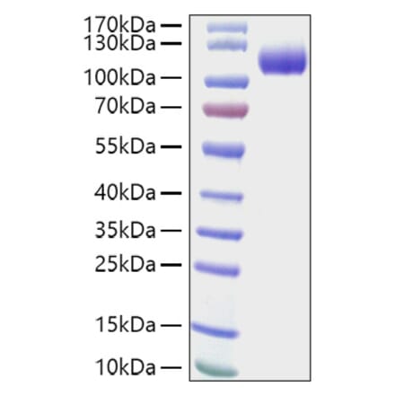 SDS-PAGE - Recombinant Human CDCP1 Protein (C-terminal His Tag) (A330434) - Antibodies.com