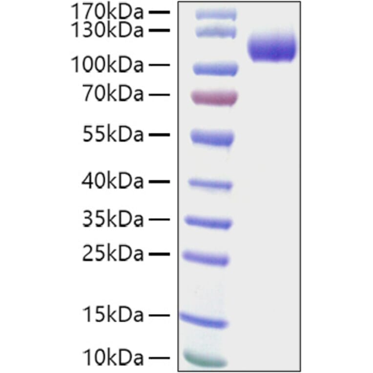 SDS-PAGE - Recombinant Human CDCP1 Protein (C-terminal His Tag) (A330434) - Antibodies.com