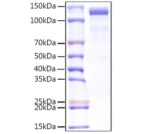 SDS-PAGE - Recombinant Human CDCP1 Protein (C-terminal Human Fc Tag) (A330435) - Antibodies.com