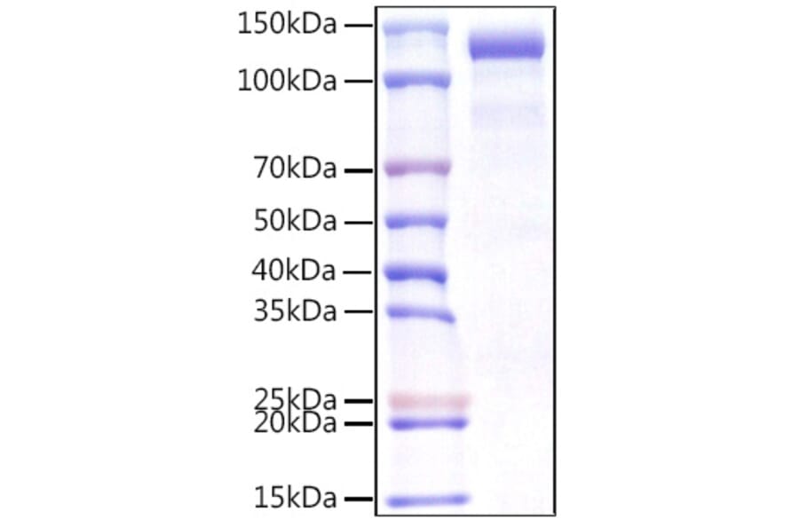 SDS-PAGE - Recombinant Human CDCP1 Protein (C-terminal Human Fc Tag) (A330435) - Antibodies.com