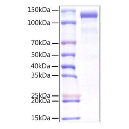 SDS-PAGE - Recombinant Human CDCP1 Protein (C-terminal Human Fc Tag) (A330435) - Antibodies.com