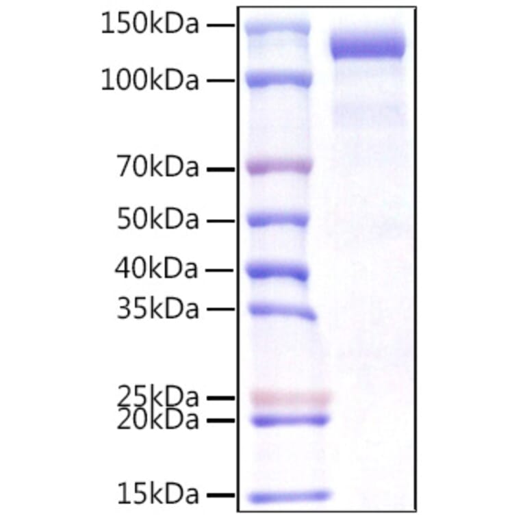 SDS-PAGE - Recombinant Human CDCP1 Protein (C-terminal Human Fc Tag) (A330435) - Antibodies.com
