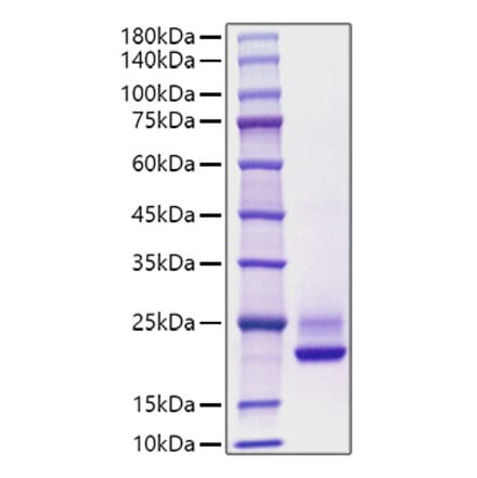 SDS-PAGE - Recombinant Human CDNF Protein (C-terminal His Tag) (A330436) - Antibodies.com