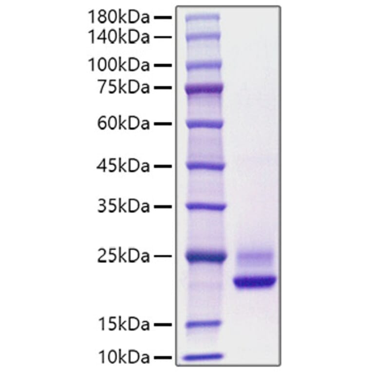 SDS-PAGE - Recombinant Human CDNF Protein (C-terminal His Tag) (A330436) - Antibodies.com