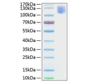 SDS-PAGE - Recombinant Human CEA Protein (C-terminal His Tag) (A330437) - Antibodies.com