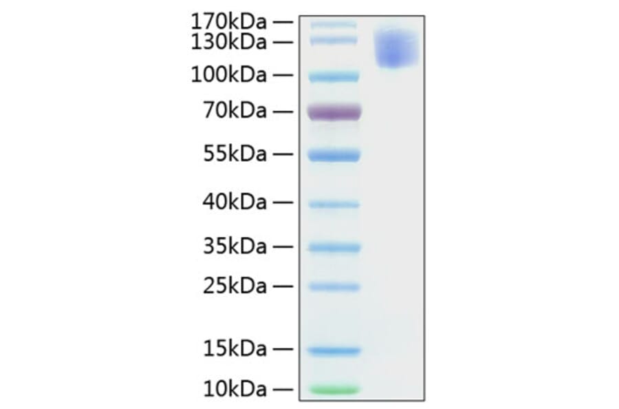 SDS-PAGE - Recombinant Human CEA Protein (C-terminal His Tag) (A330437) - Antibodies.com