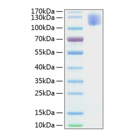 SDS-PAGE - Recombinant Human CEA Protein (C-terminal His Tag) (A330437) - Antibodies.com