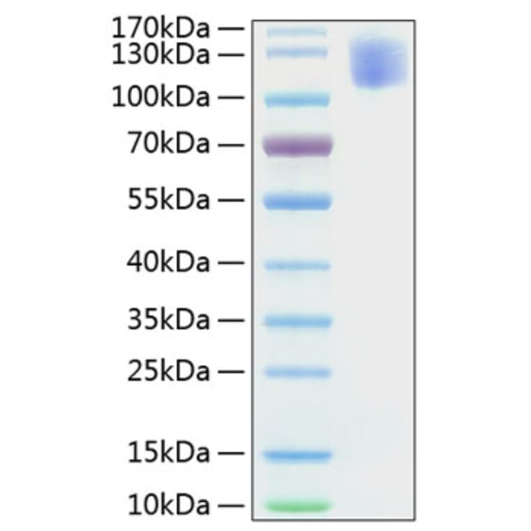 SDS-PAGE - Recombinant Human CEA Protein (C-terminal His Tag) (A330437) - Antibodies.com