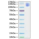 SDS-PAGE - Recombinant Human CEA Protein (C-terminal His Tag) (A330437) - Antibodies.com