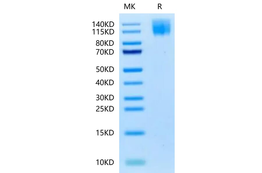 Tris-Bis PAGE - Recombinant Human CEA Protein (Biotin) (C-terminal His and Avi Tag) (A330438) - Antibodies.com