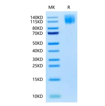 Tris-Bis PAGE - Recombinant Human CEA Protein (Biotin) (C-terminal His and Avi Tag) (A330438) - Antibodies.com