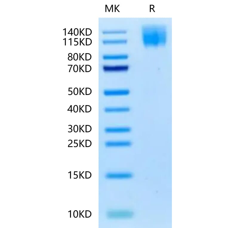 Tris-Bis PAGE - Recombinant Human CEA Protein (Biotin) (C-terminal His and Avi Tag) (A330438) - Antibodies.com