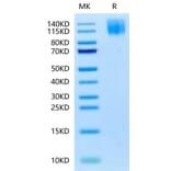 Tris-Bis PAGE - Recombinant Human CEA Protein (Biotin) (C-terminal His and Avi Tag) (A330438) - Antibodies.com