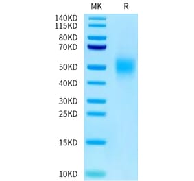 Tris-Bis PAGE - Recombinant Human CEA Protein (C-terminal His Tag) (A330439) - Antibodies.com