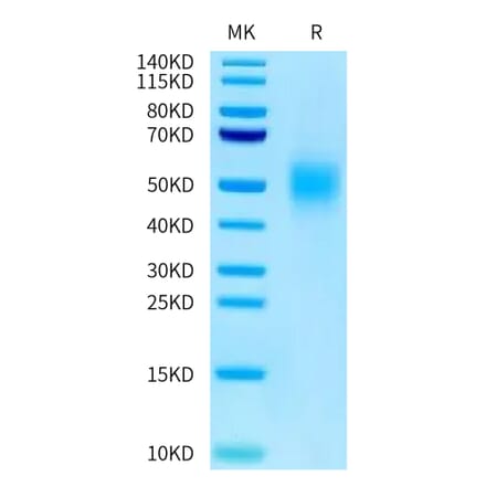 Tris-Bis PAGE - Recombinant Human CEA Protein (C-terminal His Tag) (A330439) - Antibodies.com