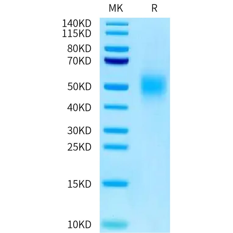 Tris-Bis PAGE - Recombinant Human CEA Protein (C-terminal His Tag) (A330439) - Antibodies.com