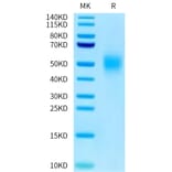 Tris-Bis PAGE - Recombinant Human CEA Protein (C-terminal His Tag) (A330439) - Antibodies.com