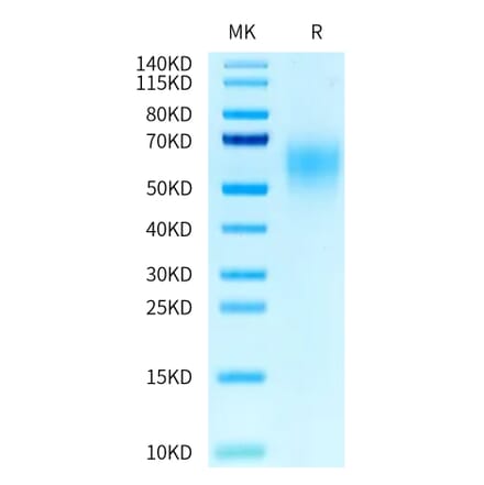 Tris-Bis PAGE - Recombinant Human CEA Protein (C-terminal His Tag) (A330440) - Antibodies.com