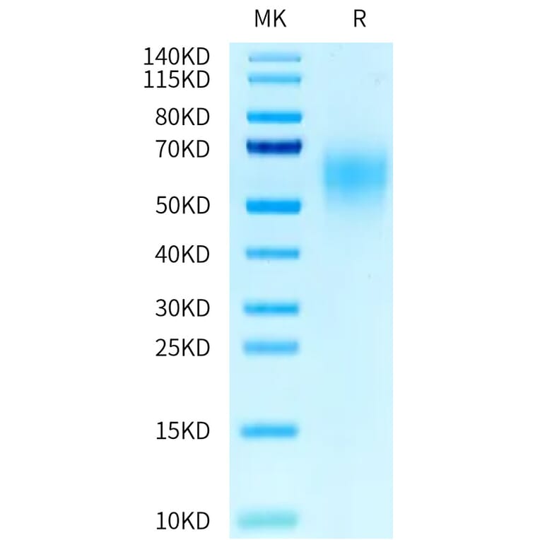 Tris-Bis PAGE - Recombinant Human CEA Protein (C-terminal His Tag) (A330440) - Antibodies.com