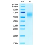 Tris-Bis PAGE - Recombinant Human CEA Protein (C-terminal His Tag) (A330440) - Antibodies.com
