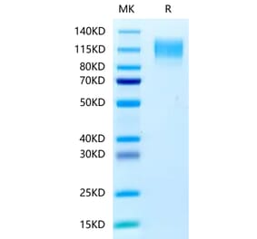 Tris-Bis PAGE - Recombinant Human CEA Protein (C-terminal His Tag) (A330441) - Antibodies.com