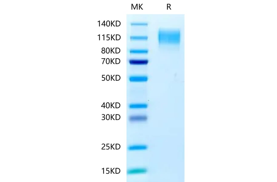 Tris-Bis PAGE - Recombinant Human CEA Protein (C-terminal His Tag) (A330441) - Antibodies.com