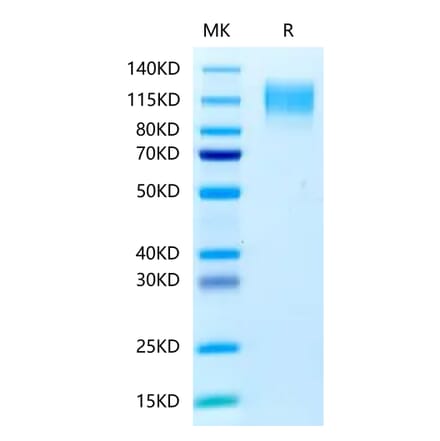 Tris-Bis PAGE - Recombinant Human CEA Protein (C-terminal His Tag) (A330441) - Antibodies.com