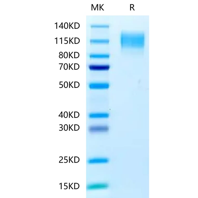 Tris-Bis PAGE - Recombinant Human CEA Protein (C-terminal His Tag) (A330441) - Antibodies.com