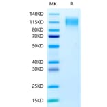 Tris-Bis PAGE - Recombinant Human CEA Protein (C-terminal His Tag) (A330441) - Antibodies.com